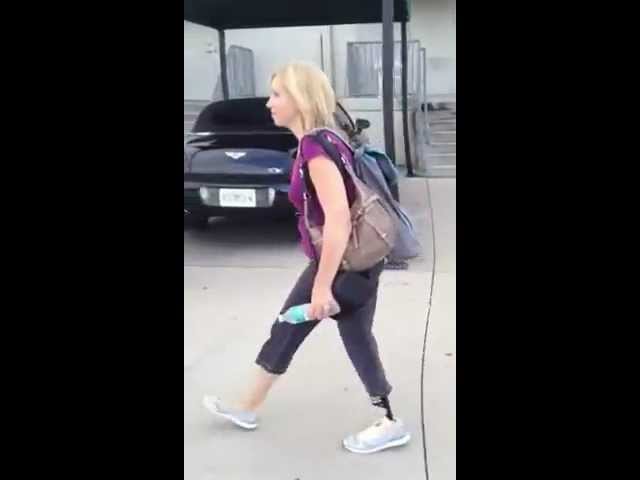 First day walking on my new prosthetic leg with Genium Knee and Blade Foot