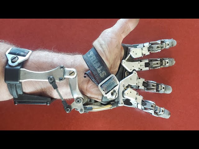Fake Prosthetic Hand?