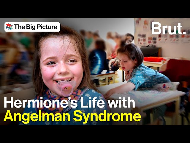 A Day in the Life with Hermione, with Angelman Syndrome