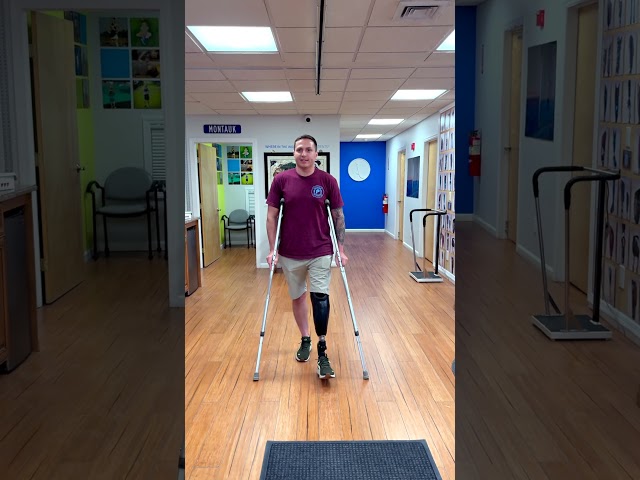 Carlos's Progress Using a Below-Knee Prosthetic Leg