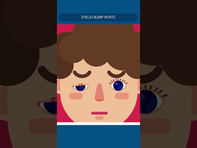 Why Your Eyelid Became Red Overnight