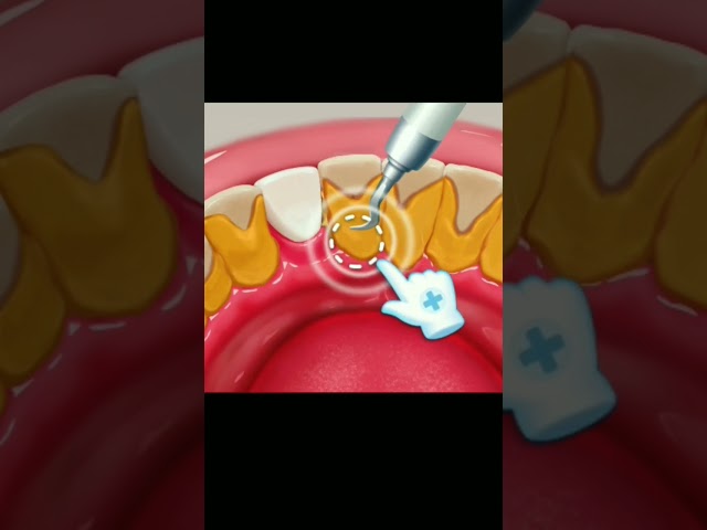 mouth treatment 😮💥 #shorts #treatment #games #asmr #viral #trending