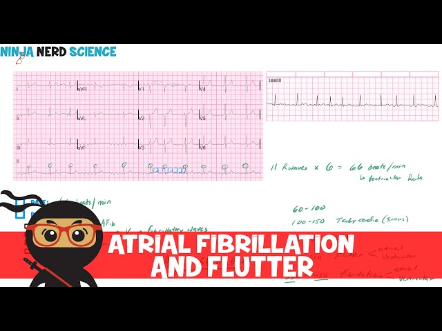 Rate and Rhythm | Atrial Fibrillation and Atrial Flutter