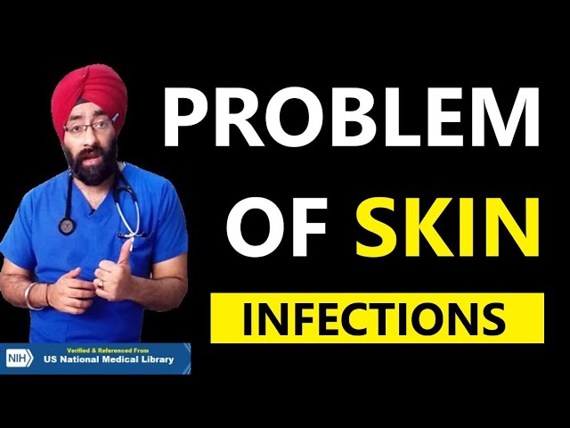 Fungal Bacterial Viral & Parasitic SKIN Infections | Dr.Education