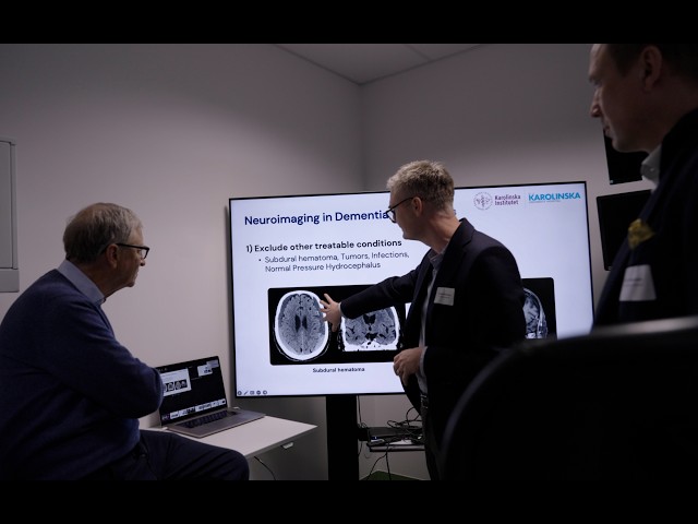 Amazing progress on Alzheimer's disease
