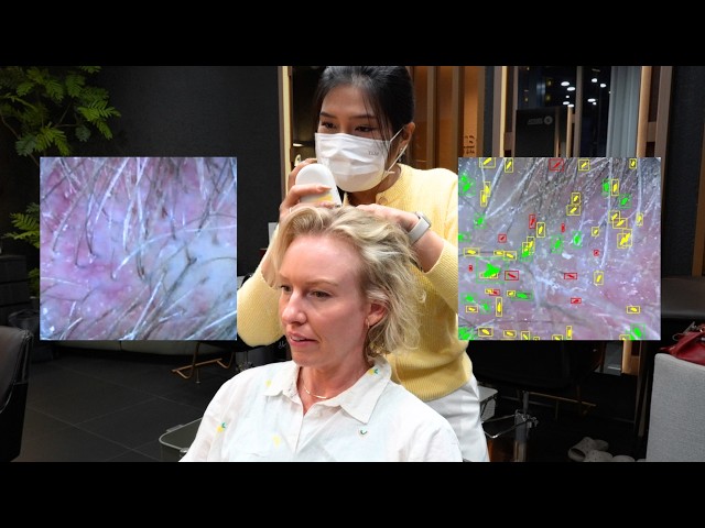 The Most In-Depth Hair & Scalp Analysis I've Ever Had! 🇹🇭
