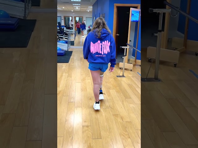 Below-Knee Prosthetic Leg, Silicone Foot, and Partial Foot in Use | Gracie