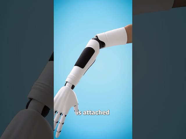How A Bionic Arm Works 😲 Surgeon Reacts