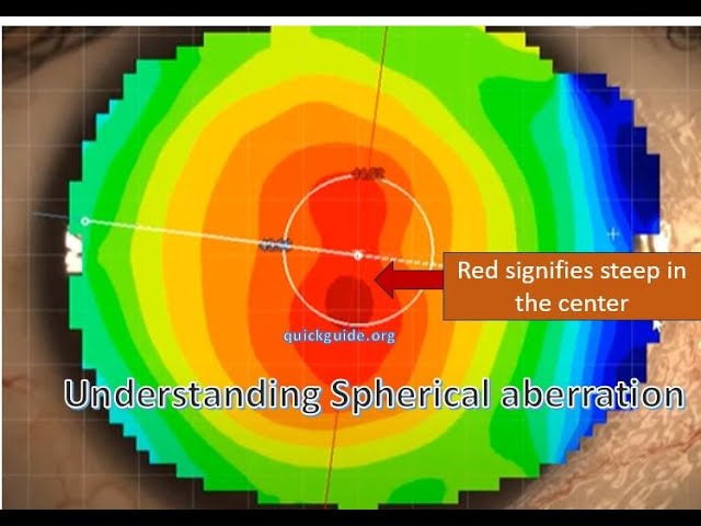 Understanding Spherical Aberration and aspheric IOLs- Part II (follow quickguide.org)