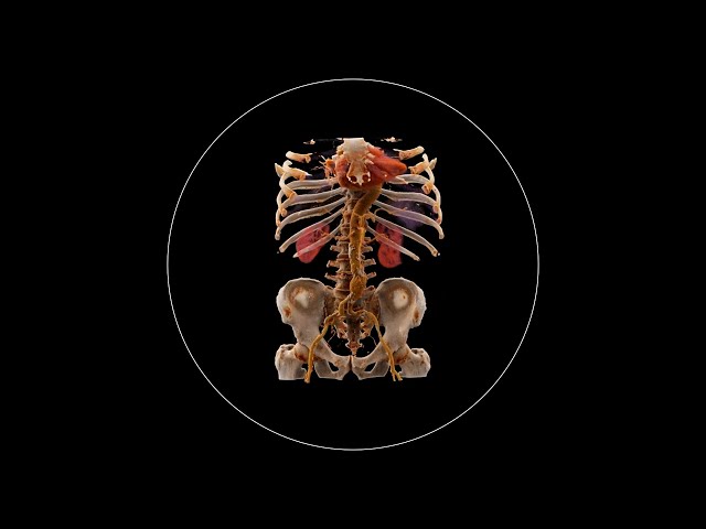What is Computed Tomography (CT) and how does it work?