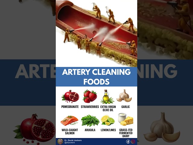 Top Artery Cleansing Foods to Reduce Arterial Plaque 🛑