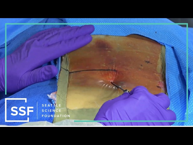 Advances in Spinal Cord Stimulation - Pratik Gandhi, D O