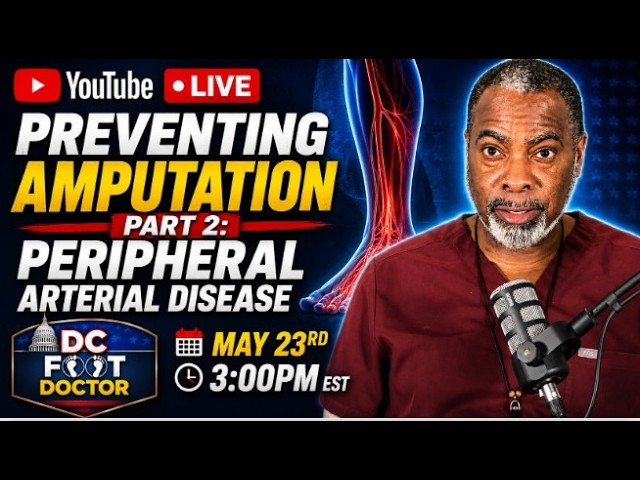 Amputation Prevention, Part 2: Peripheral Arterial Disease