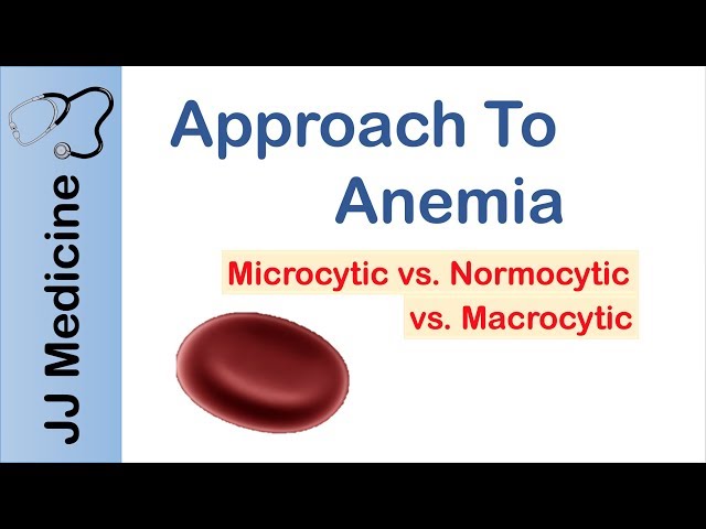 Anemia | Microcytic vs. Normocytic vs. Macrocytic
