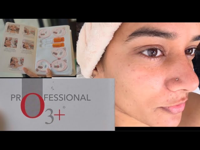 Full Tutorial O3 The Best Bridal Facial Kit for Oily and Pigmented Skin//The Best facial for Bridal