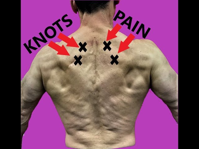 Absolute Best Rhomboid Pain Relief Exercises