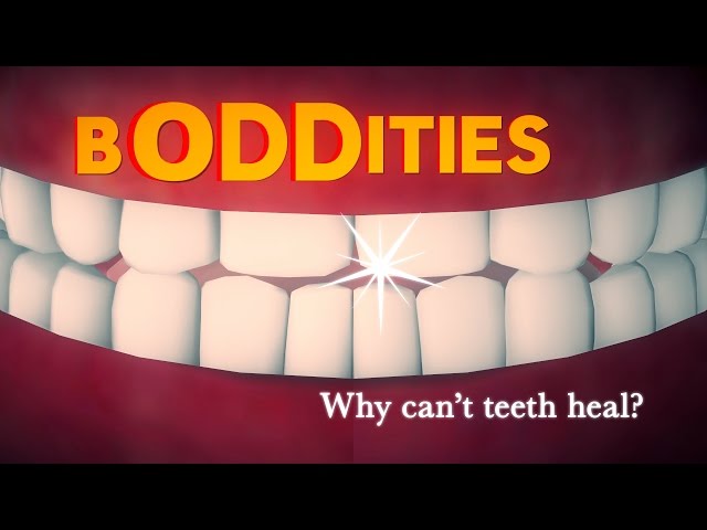 Boddities | Episode 9 | Why can't teeth heal?
