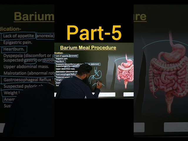 Hiatus Harnia 🧍 Abdominal Pain #xray #ct #anatomy #mri #biology #science #neet #medicalstudent
