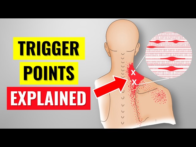 What Science ACTUALLY Says About Trigger Points & Myofascial Pain