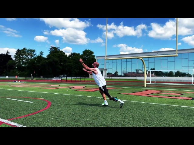 Rotationplasty Amputee | High Activity Soccer Prosthesis | #cancersurvivor