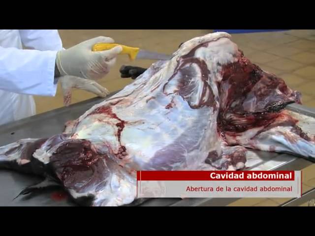 Cavidad abdominal: cortes de referencia