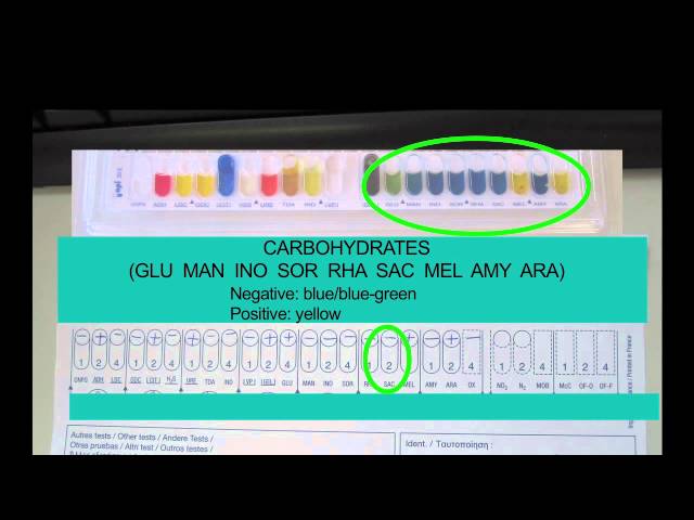 Microbiology: Using API Strips 3