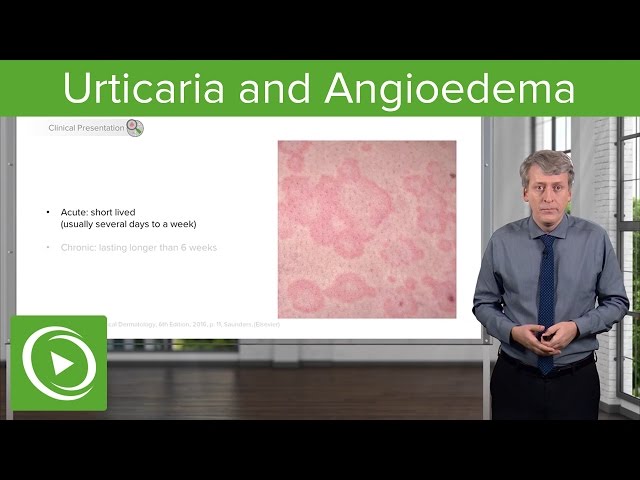 Urticaria (Hives) and Angioedema – Pediatrics | Lecturio