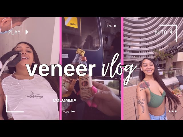 I got Veneers! | Dr. Juan Camilo Aristizabal in Cali, Colombia