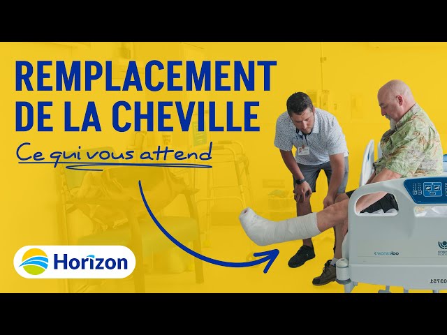 Remplacement de la cheville : ce que vous devriez savoir
