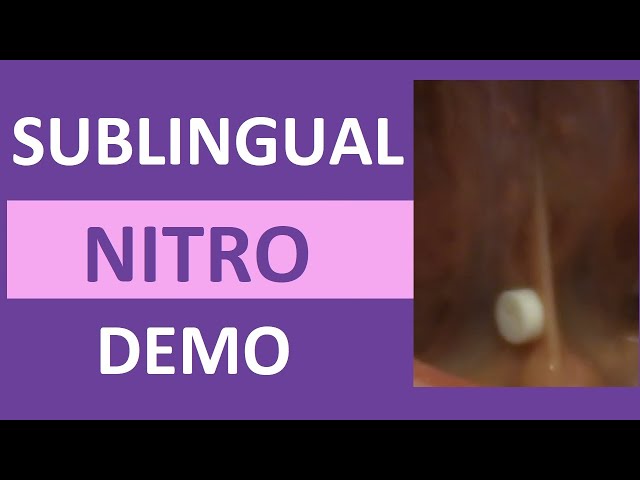 Nitroglycerin Medication Nursing Sublingual Tablets & Oral Spray Pharmacology Review & Adminstration