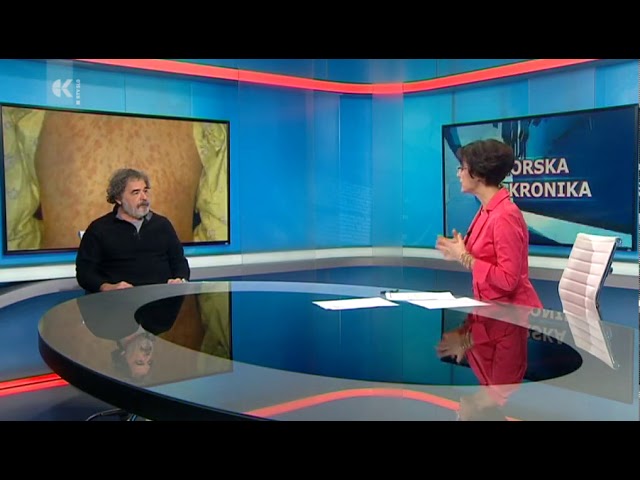 RTVSLO TV Koper, Virus ošpic, cepljenje, dr. Gorazd Pretnar