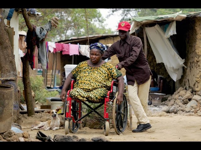 Prosthetic socket aims to help 27,000 amputees in Sierra Leone - BYU Engineering Capstone