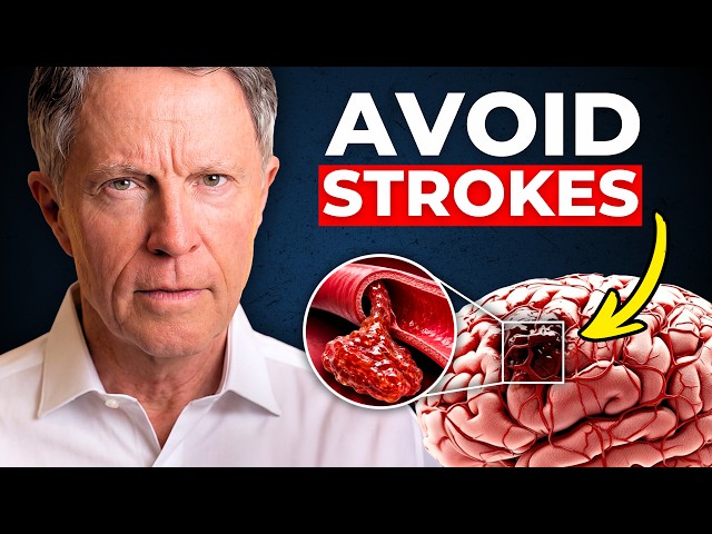 The EXACT Formula to Avoid a Stroke (Doctors Won't Tell You)