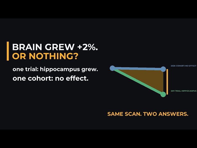 A Landmark Trial Grew Brains With Exercise. A Bigger Study Found Nothing.