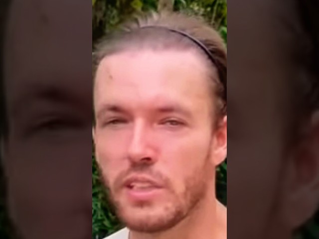 The Evolution of Sv3rige’s Hairline