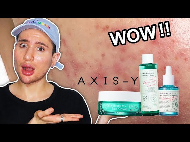Fade ACNE MARKS! How to Get Rid of DARK SPOTS and HYPERPIGMENTATION in WINTER! (with AXIS-Y)