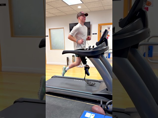 From First Steps to Running Blade: Prosthetic Transformation | Jack