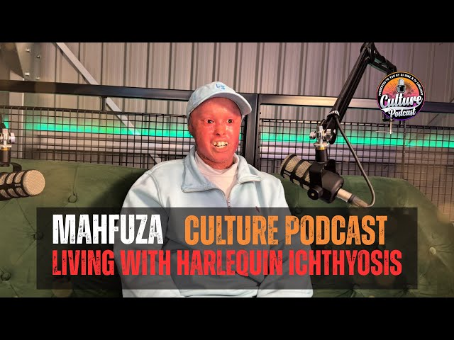MAHFUZA - Living with Harlequin Ichthyosis | From being Bullied to TikTok Fame (CULTURE PODCAST)