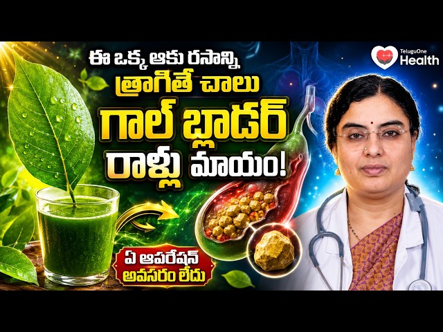 ఆపరేషన్ లేకుండా గాల్‌బ్లాడర్ రాళ్లకు చెక్ | Gallbladder Stones Symptoms and Treatment | Dr SGV Satya