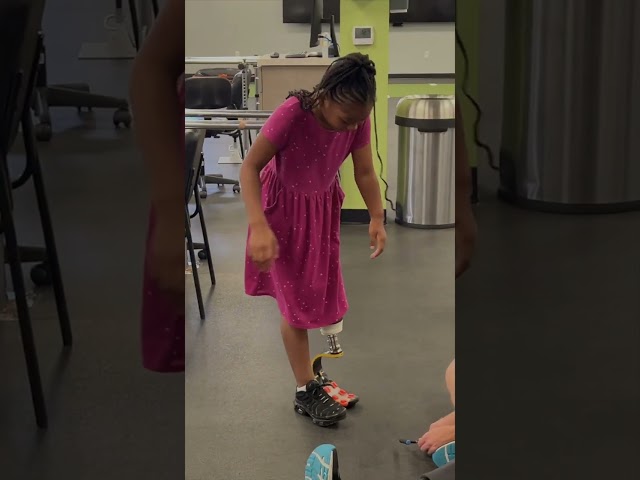 Mirai,  BK amputee with fast new running blade!