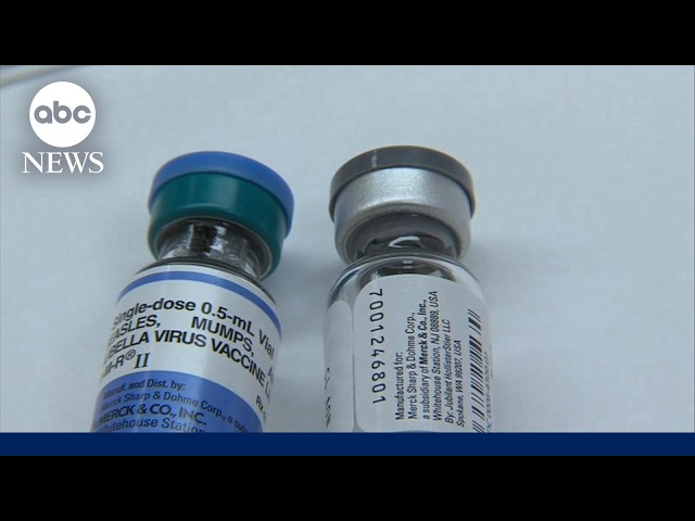 Former CDC specialist breaks down largest measles outbreak in 35 years