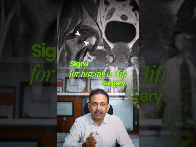 Do U need Surgery for AVN or Ankylosing Spondylitis- How to know yourself ? #hipreplacementsurgery