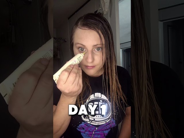 15 Days of This Eye Cream helps reduce hyper pigmentation #julyglowambassador #saggingskin #skincare