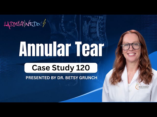 Case study 120 - Annular Tear EXPLAINED by Dr. Grunch, board-certified neurosurgeon