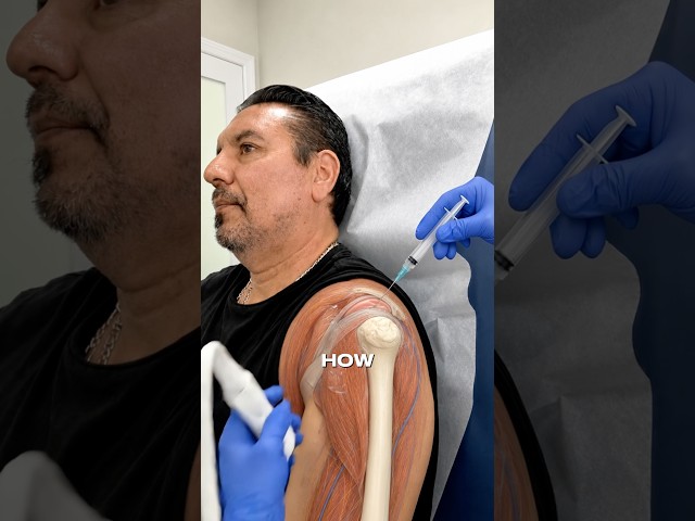 How to relieve shoulder pain? #painrelief #painmanagement