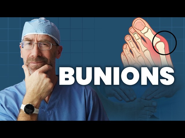 What Is a Bunion—and What Can You Do About It?