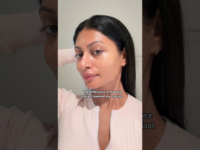 Skin Transformation After Lowering Cortisol