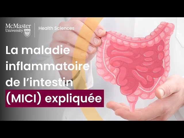 La maladie inflammatoire de l’intestin (MICI) expliquée (affection abdominale inflammatoire)