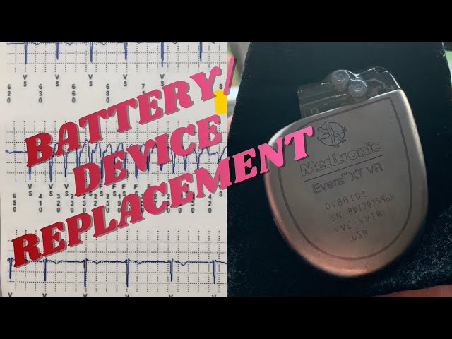 Battery/Device replacements for pacemakers and defibfrlators