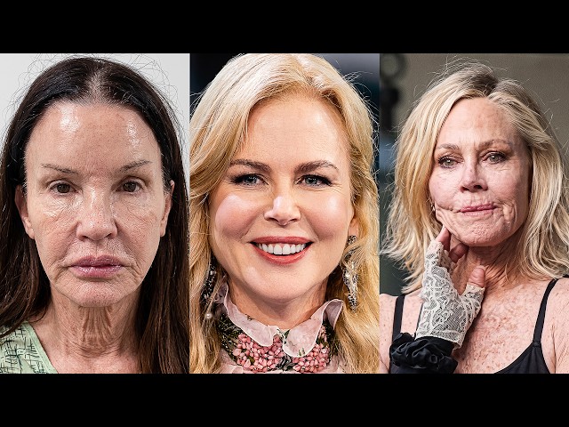 15 Hollywood Stars Whose Facelifts Went Too Far (It's Getting Worse)